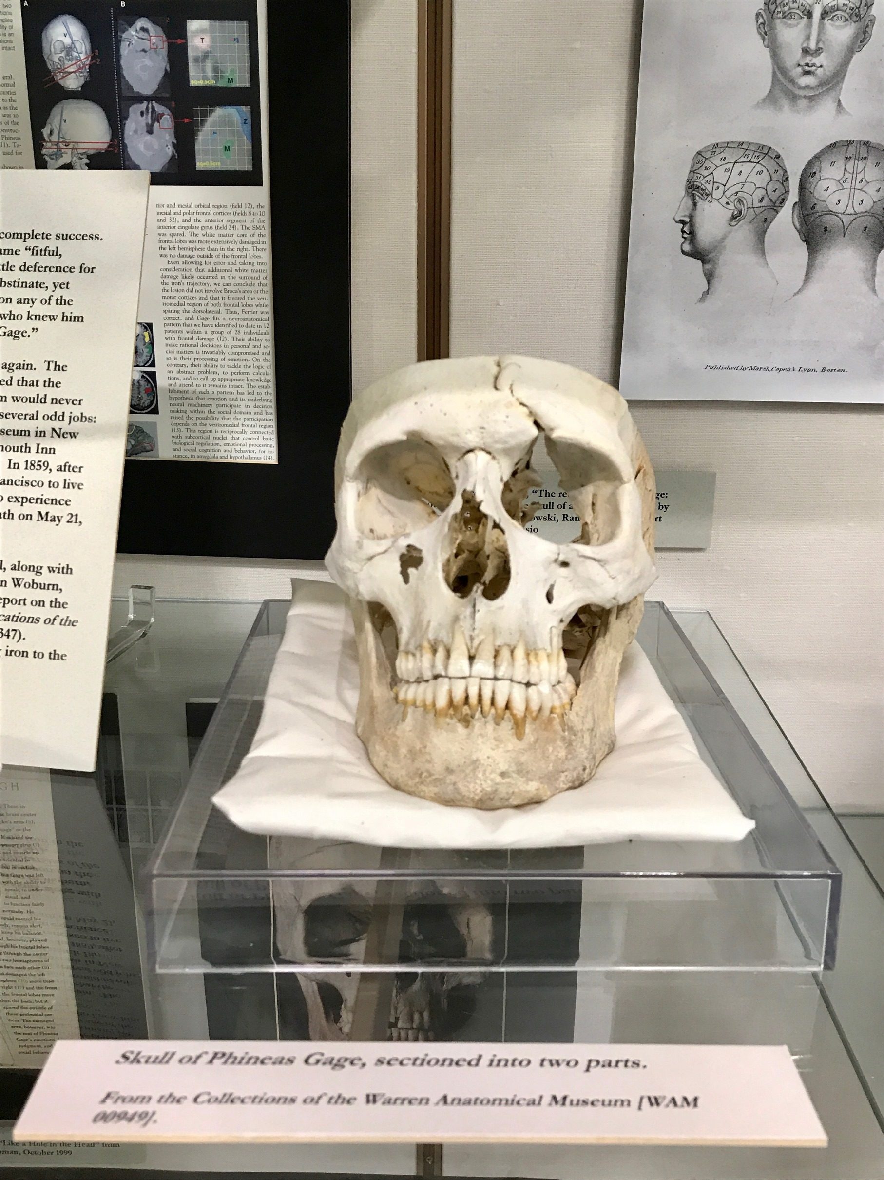 Phineas Gage memorabilia, Warren Anatomical Museum, Boston (by Luca Ambrosio) - 03.jpg